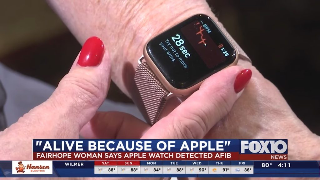 Apple Watch: EKG-App erkennt rechtzeitig eine gefährliche